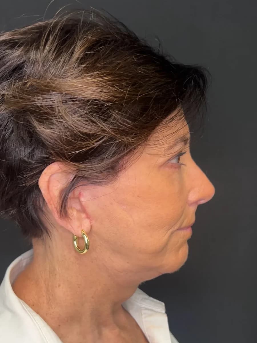 Profile view of a woman with short dark hair against a grey backdrop, showing the jawline and neck
