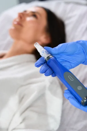 Microneedling at Mafi Plastic Surgery