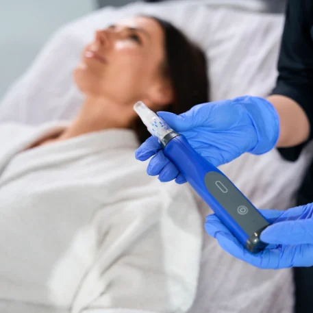 A microneedling handpiece being drawn across a reclined patient’s cheek