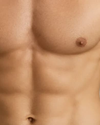 Gynecomastia at Mafi Plastic Surgery