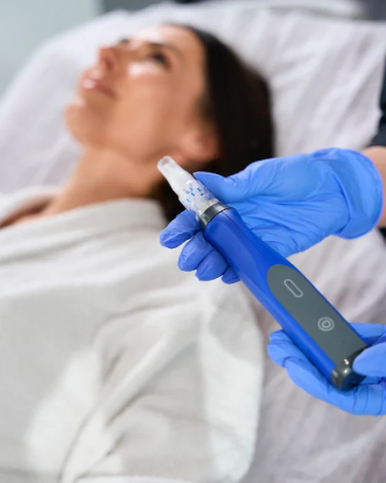 Microneedling at Mafi Plastic Surgery